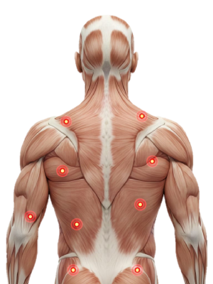 PGM ABORDAJE OSTEOPÁTICO DE LOS PUNTOS GATILLO MIOFASCIALES