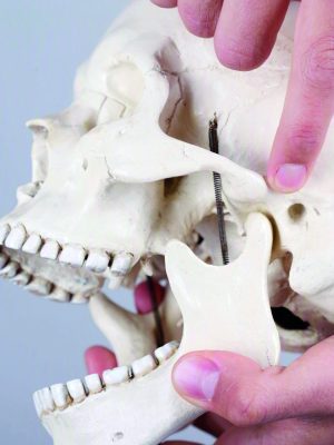 ABORDAJE OSTEOPÁTICO DE LA ARTICULACIÓN TEMPOROMANDIBULAR